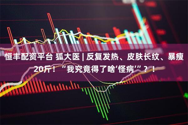 恒丰配资平台 狐大医 | 反复发热、皮肤长纹、暴瘦20斤！“我究竟得了啥‘怪病’”？！